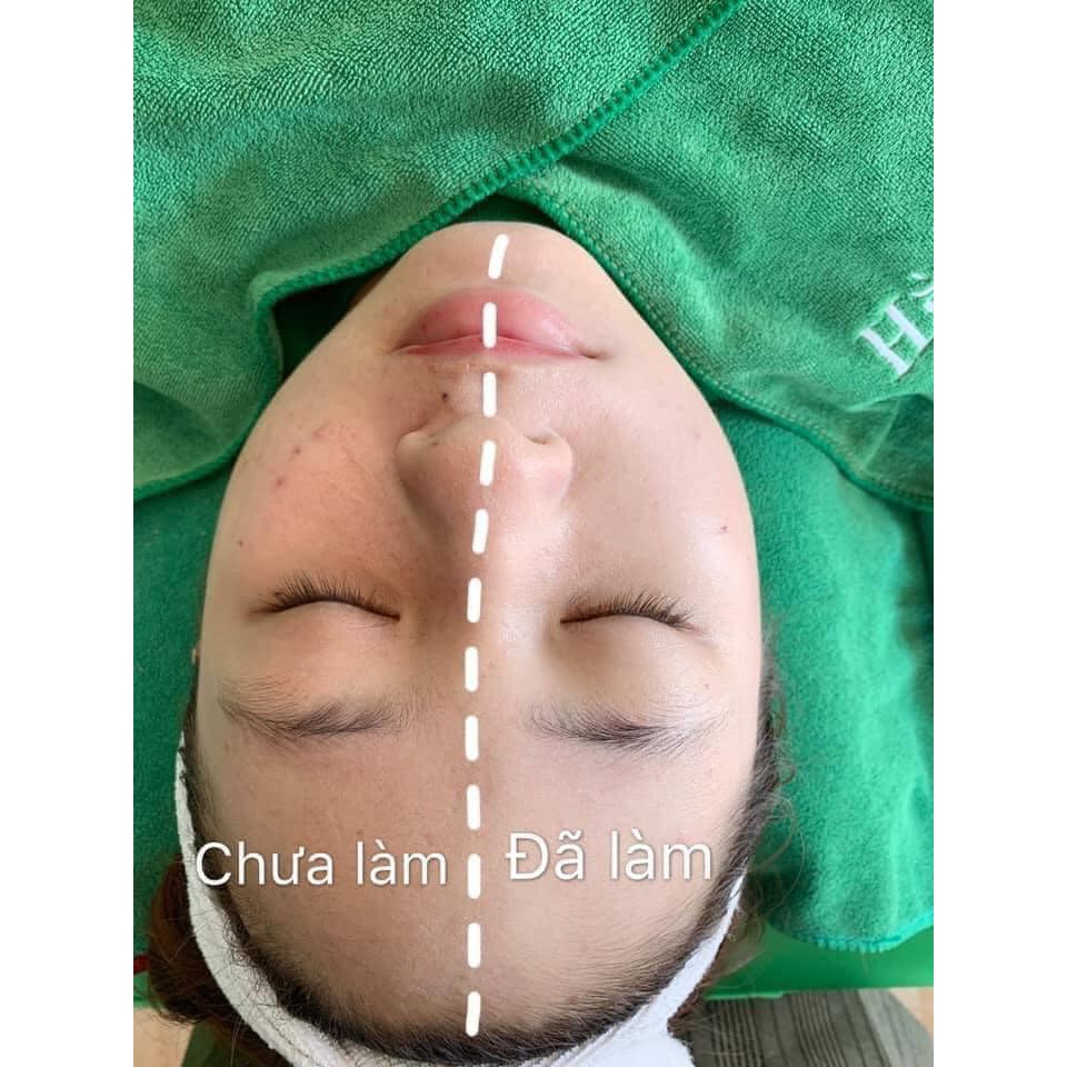 Ảnh 5